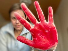Red_hand_Day_21.jpg